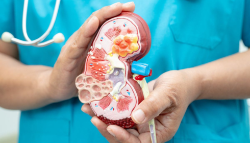 Finding the Best Kidney Care: Top Nephrologists in Bangalore