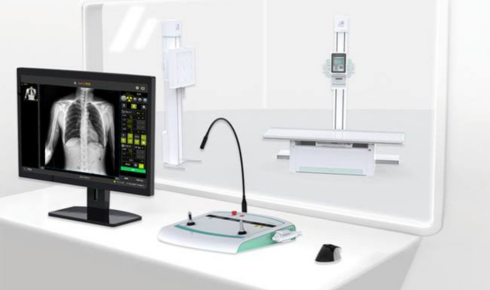 How Digital Detector Technology Is Transforming Modern Radiography Care