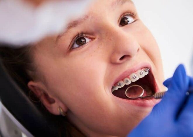 When Do Kids Need Braces? Early Orthodontic Warning Signs
