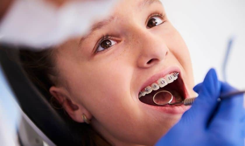 When Do Kids Need Braces? Early Orthodontic Warning Signs